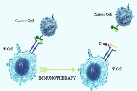 Immunotherapy Treatment And Cost Guide