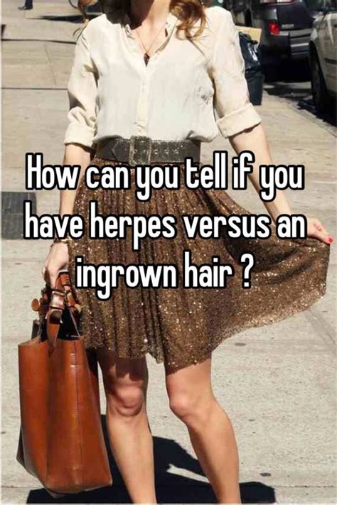 View an illustration of herpes zoster and learn more about viral skin diseases. How can you tell if you have herpes versus an ingrown hair