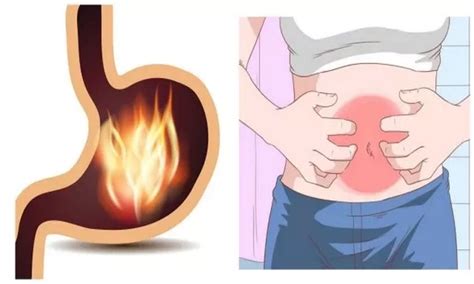 Eat small, frequent meals:if you're suffering from gastritis, it's easy for your stomach to tolerate small and frequent meals rather than large meals. Terrible Say Goodbye To Gastritis, Discover How To Cure It ...