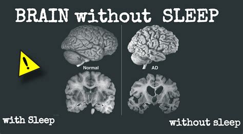 what will happen to your brain if you don t sleep…