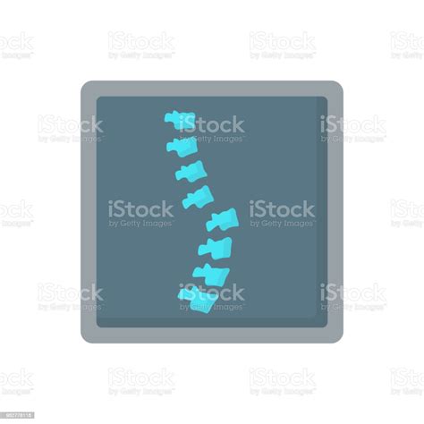 Back Xray Broken Bones Medicine Flat Vector Icon Stock Illustration