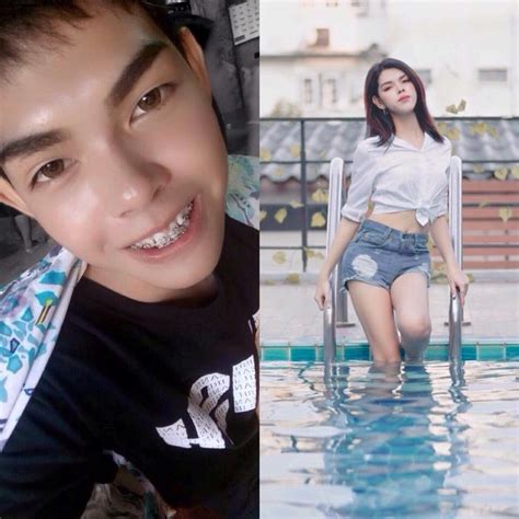 Bandingkan dengan biaya operasi transgender di amerika yang menelan biaya rp1 milyar, dua setengah kali lipatnya. Transformasi Transgender Cantik Thailand yang Bikin Tertipu