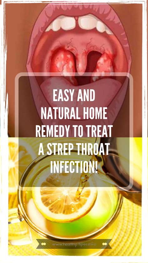 easy and natural home remedy to treat a strep throat infection in 2020 natural home remedies