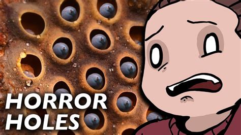 Why Trypophobia Is Not Real And How To Cure It Youtube