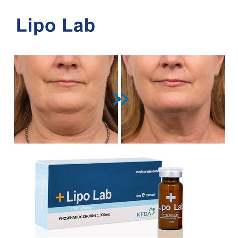 Lipo Lab Lipolysis Fat Dissolve Injection Made Of Korean For Double