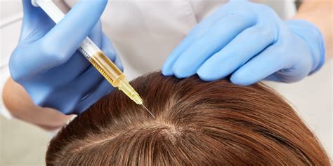 Prp Hair Loss Treatment At Dr Richas Unique Clinic We Have Been Performing Prp Therapy As A