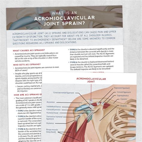 What Is An Acromioclavicular Joint Sprain Adult And Pediatric
