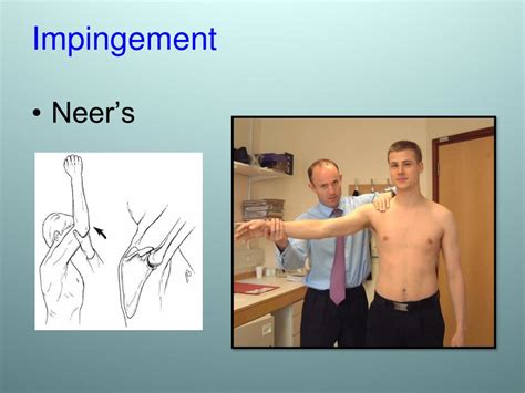 Ppt Shoulder Examination And Common Pathology Powerpoint Presentation
