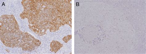 Judgment For P16 Immunohistochemistry Ihc And In Situ Hybridization