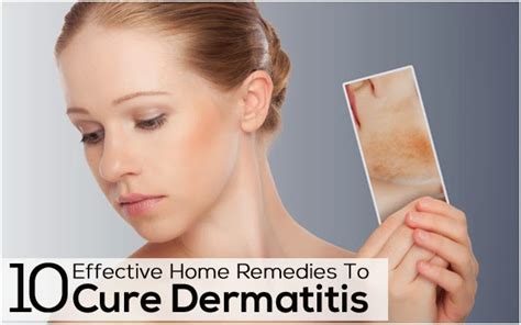 10 Effective Home Remedies To Cure Dermatitis ~ Mzizi Mkavu