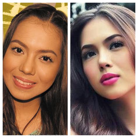 Health Insurance Before And After Julia Montes