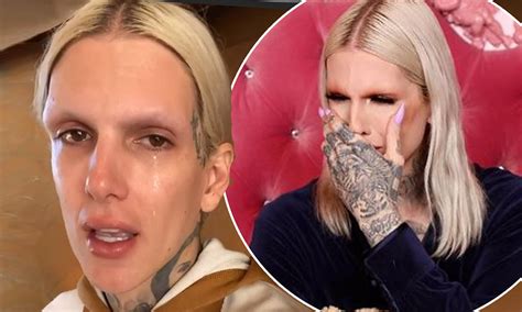 Jeffree Star Before And After