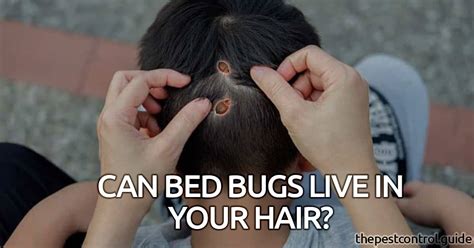 Can Bed Bugs Live In Your Hair And Stay On Your Head