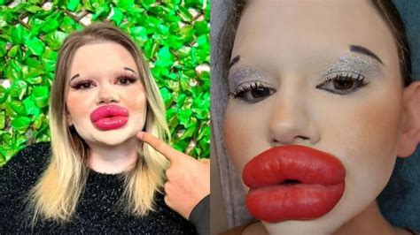 [fotos] mujer con los labios más grandes del mundo busca batir un nuevo récord con sus mejillas