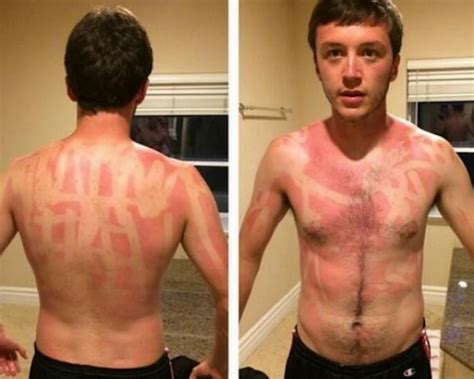 15 Epic Tanning Fails That Prove Some People Should Just Stay Indoors Page 2 Of 5