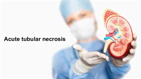 Acute Tubular Necrosis Causes Symptoms Diagnosis And Treatment