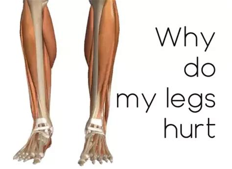 Why Do My Legs Hurt Health Advisor