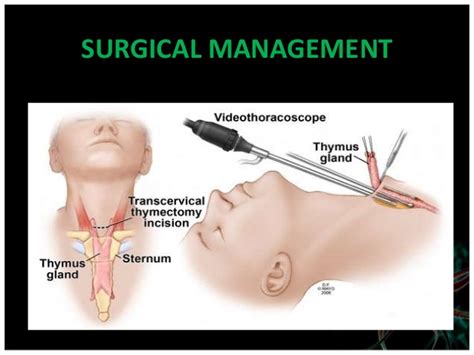 How is myasthenia gravis diagnosed? MYO Therapy & Healthcare Institute: Myasthenia gravis(MG)