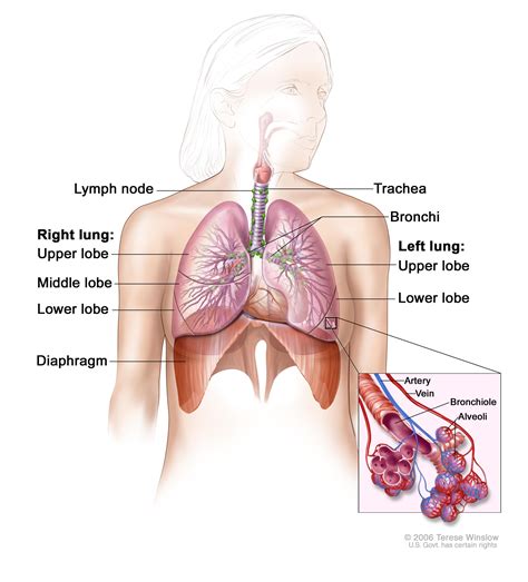 This happens when a tumor causes extra pressure on the nerve which controls your larynx it is quite an unusual symptom, but lung cancer is the most common cause, so if you notice changes like this, then get them checked out. Small Cell Lung Cancer Treatment (PDQ®)-Patient Version ...