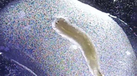 magnified roundworm youtube
