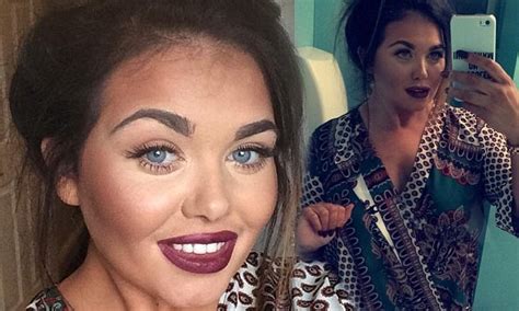 Goggleboxs Scarlett Moffatt Reveals She Wants To Go Under The Knife For A Breast Reduction
