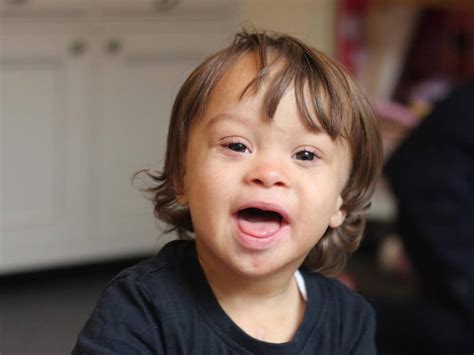 Adorable Boy With Down Syndrome Became A Model For Amazons Charity