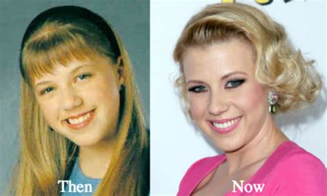 Jodie Sweetin Plastic Surgery Before And After Photos Latest Plastic
