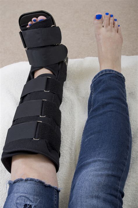 How To Tell If Your Foot Is Fractured Heiden Orthopedics Post Op Shoe For Broken Foot Or Toe
