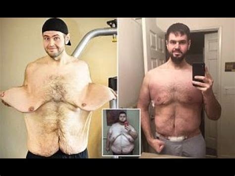 Morbidly Obese Man Shows Off His Incredible 350lbs Weight Loss