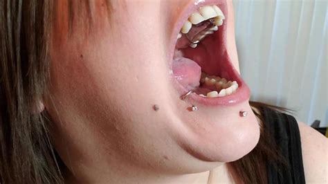 Young Gal Wearing Partial Dentures Porn Videos