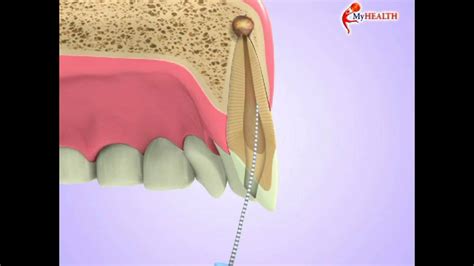 Kesehatan gigi dan mulut menjadi perhatian bagi banyak orang saat ini. Rawatan Akar Gigi Klinik Kerajaan - AKARKUA
