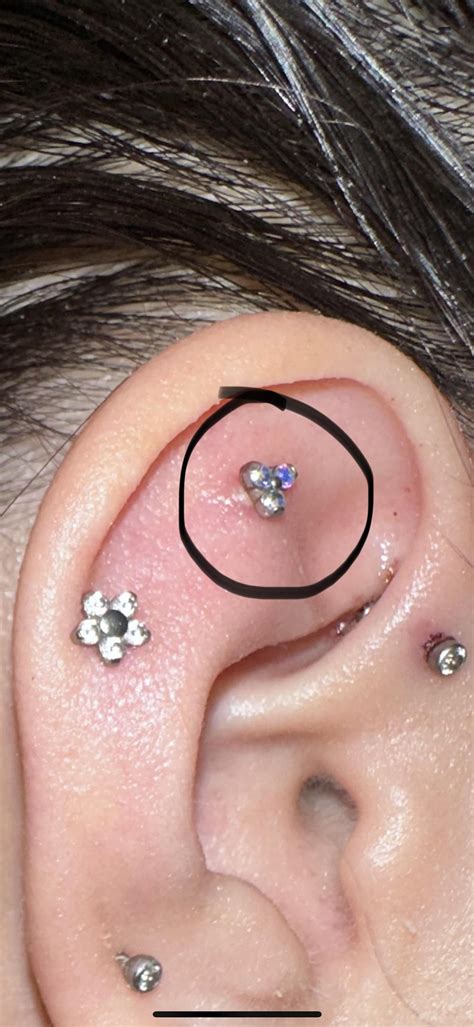 Piercing Bump Formed From Getting Hit How To Get Rid Of It Rpiercing