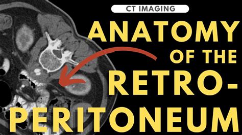 Retroperitoneal Anatomy Organs And Spaces Radiology Anatomy Part 1