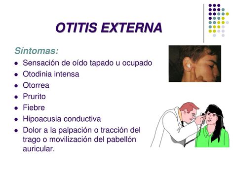 Ppt Otitis Powerpoint Presentation Free Download Id4511398