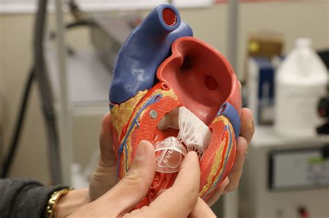 New Study Could Revolutionize Heart Valve Replacement Technology