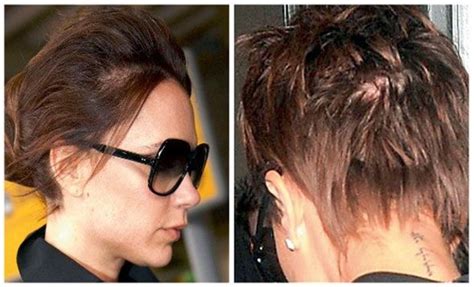 Learn why postpartum hair loss occurs around 3 months after birth. Loosing hair after giving birth is totally normal. It even ...