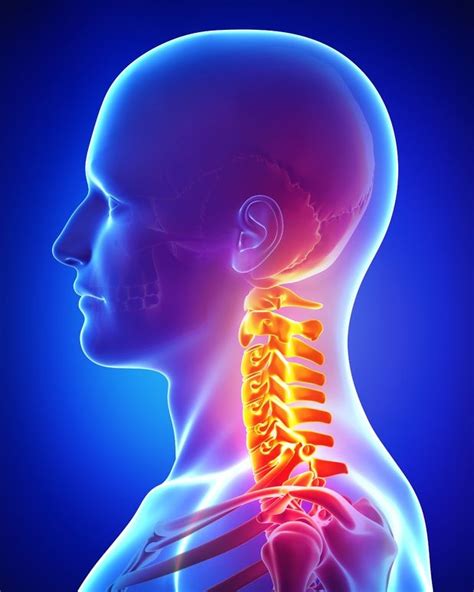The Multifactorial Causes And Solutions To Chronic Neck Pain Msk