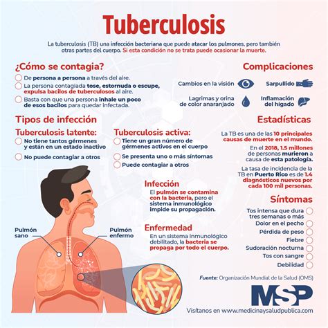 Tuberculosis Infograf A