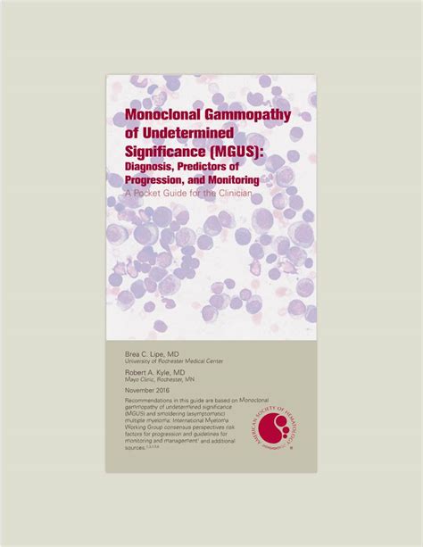 Monoclonal Gammopathy Of Undetermined Significance Mgus Diagnosis