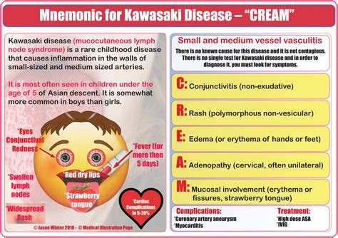 Mnemonic For Kawasaki Disease Cream Diagnosis Peds Grepmed