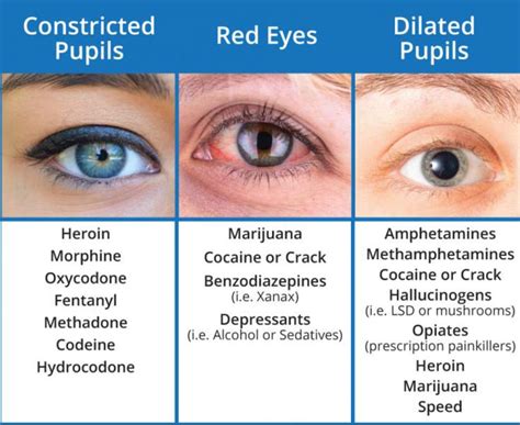 Pin By Gia Morreale On Medicine Medical Knowledge Dilated Pupils