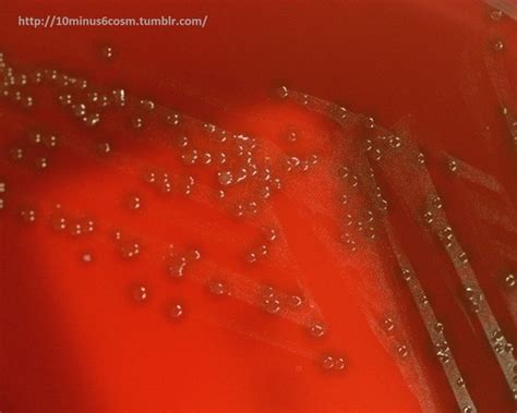Streptococcus Pneumoniae Colony Morphology