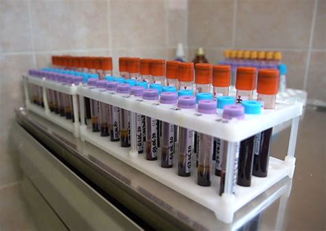 I must admit that i write this article with some caution, because i am acutely aware that the slightest hint of criticism of a vaccine, any vaccine, is risky. Military Personnel Volunteer for Covid-19 Vaccine Test ...