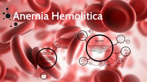 Anemia Hemolítica By Pâmella Zorzan On Prezi