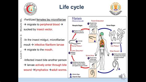 Parasitic Infection Of Lymphatic System Youtube