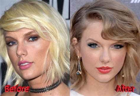 Taylor Swift Plastic Surgery Before And After Many People Are Lately Talking About The