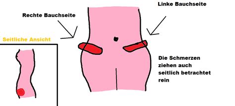 Unter einer blinddarmreizung versteht die medizin die reizung des blind endenden wurmfortsatzes des blinddarms. Schmerzen Bauch Abwechselnd (Bauchschmerzen)