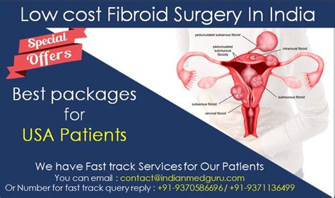 How do i choose a dental insurance plan? Indian Med Guru Offers Low cost Fibroid Surgery packages in India for USA Patients | Fibroid ...