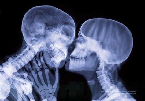 Immagine Di Love Kiss And Skeleton Xray Art Art Anatomy Art