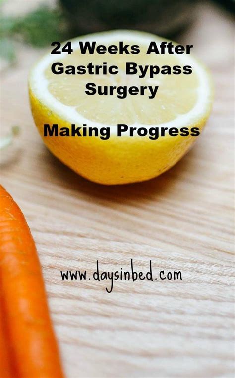 Pin On Bariatric Surgery